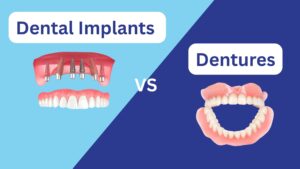 Read more about the article Dental Implants or Dentures: How to Choose The Right Replacement for You