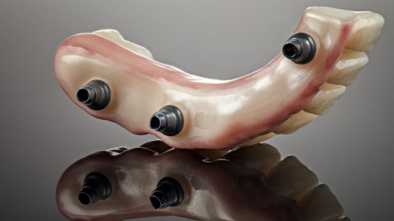 Why Dental Implants Hurt