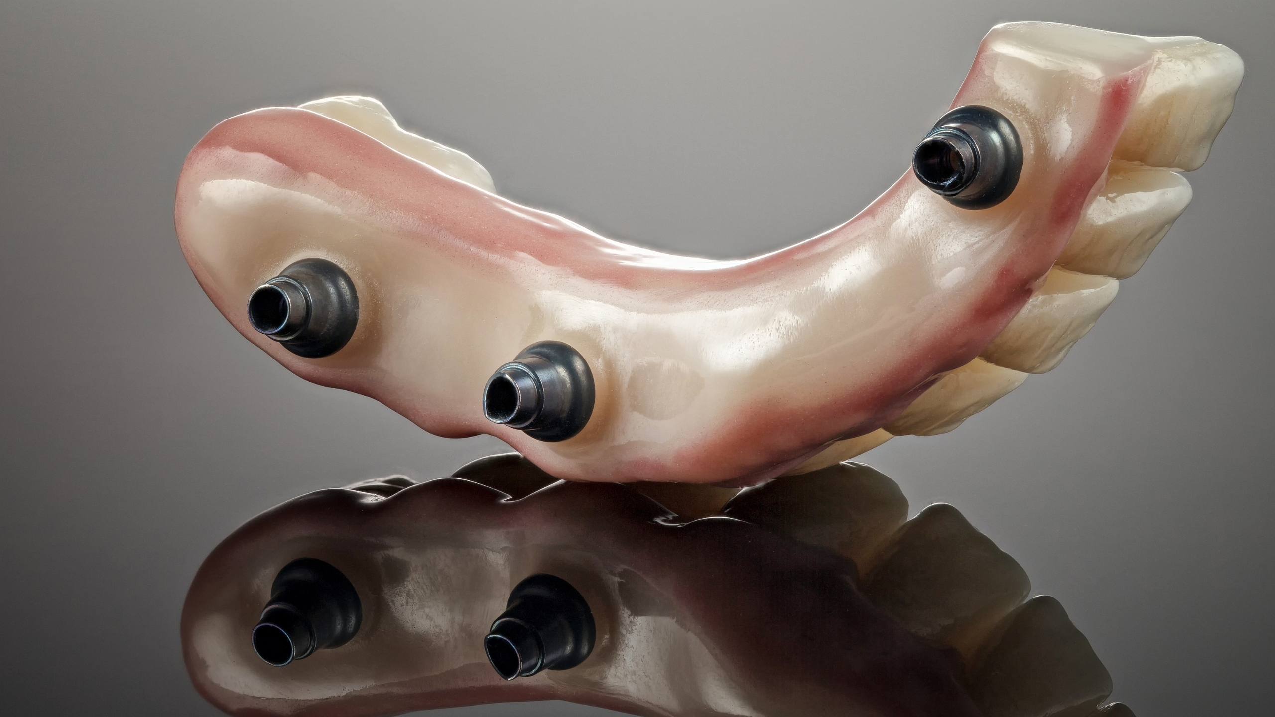 You are currently viewing Why Dental Implants Hurt