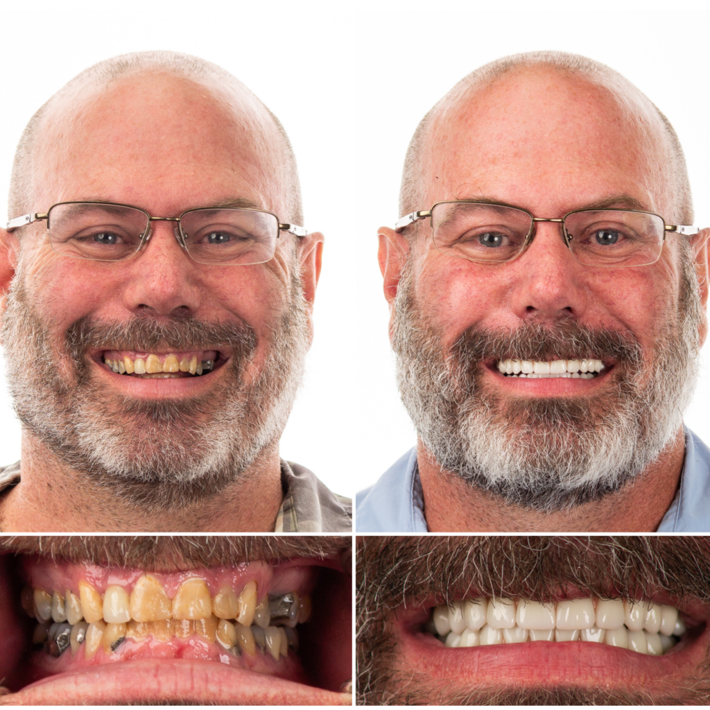 Tennessee dental implant center