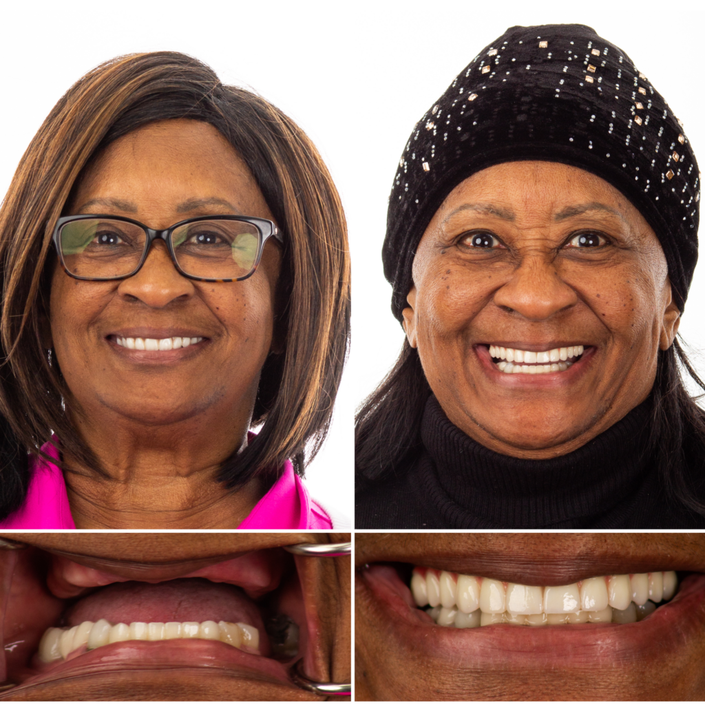 dental implant chattanooga