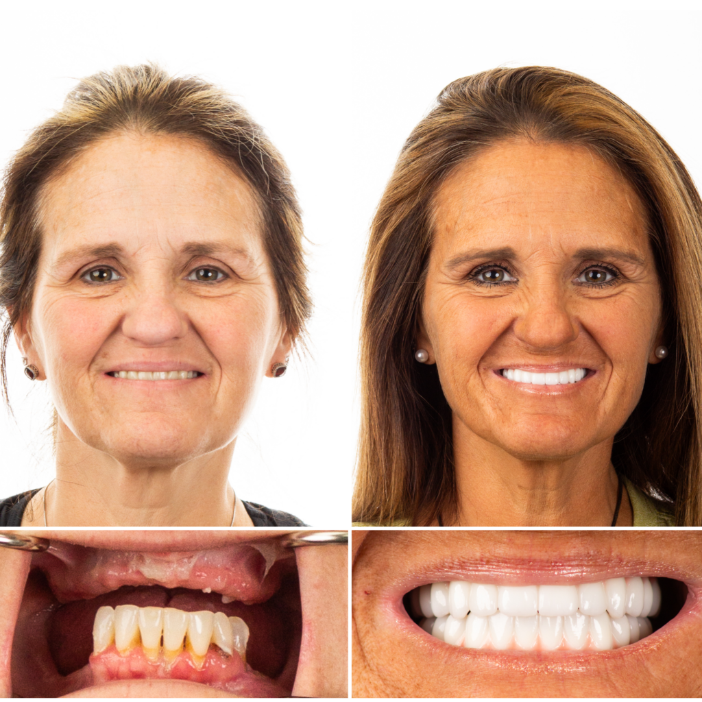 beautiful smile transformation